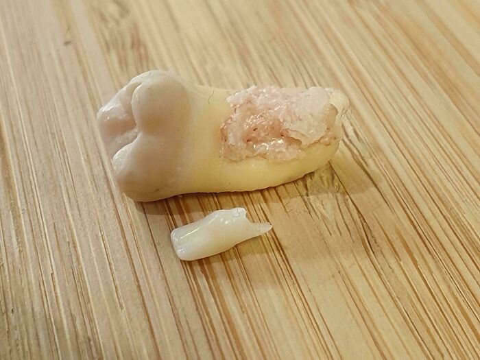 Two extracted human teeth on a wooden surface showing bizarre and fascinating body features close-up.