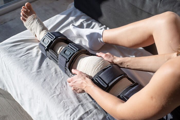 Person with a heavily bandaged leg wearing a leg brace resting on a bed, highlighting the impact on unhinged parents diabolical behavior.