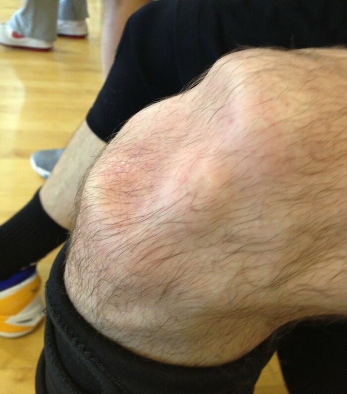 Close-up photo of a hairy human knee showing skin texture and details of the human body in a casual setting.